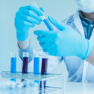 In-Vitro Diagnostics Market - Industry Analysis, Size, Share, Growth, Trends, and Forecast 2025