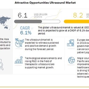 Technological advancements and new product launches driving the growth of the Ultrasound Market