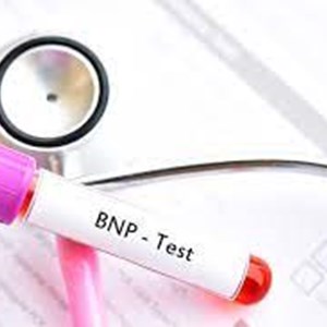 Global Brain Natriuretic Peptide (BNP) Test Market 2021 Trends, Demand and Scope with Outlook, Business Strategies and Forecast 2027