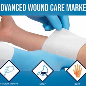 Asia-Pacific Advanced Wound Care Market Set for Rapid Expansion in Coming Years