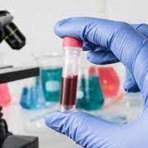 Blood Screening And Typing Market Trends, Share, Analysis, Growth & Forecast 2022 to 2030