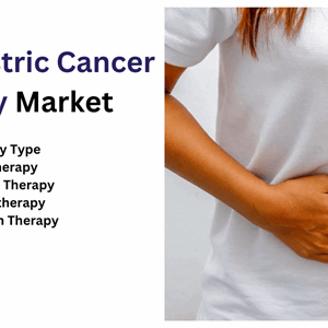 Gastric Cancer Therapy Market Industry, Trend Analysis and Forecast 2016 - 2030 