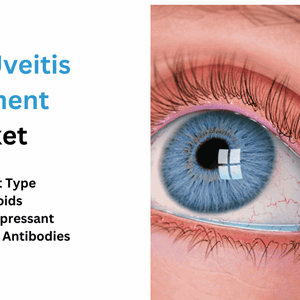 Uveitis  Market In-depth Insights by 2030 Business Strategies and Huge Demand by 2030