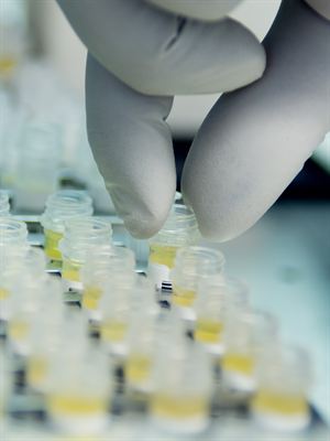 Biomarkers Market Growth Drivers and Future Trends in Diagnostic and Therapeutic Applications - Expected to reach USD 125.6 billion by 2031