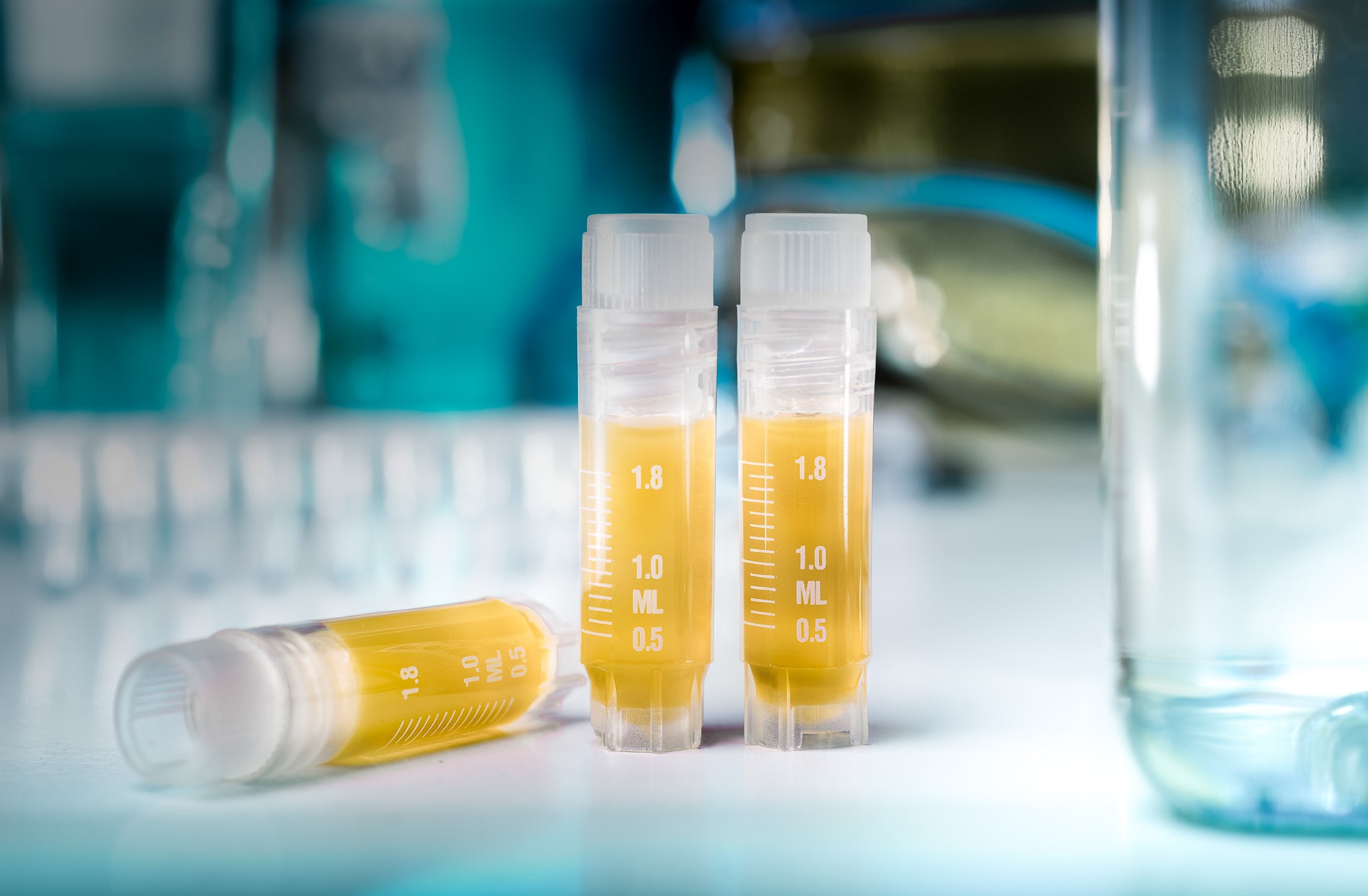 Serum, Plasma, and Human Biospecimens — Expert Buyer’s Guide for Biomedical R&D