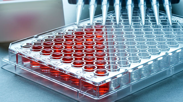Microplate Systems Market Is Booming So Rapidly| Thermo Fisher Scientific; Danaher Corporation; Agilent Technologies Inc; PerkinElmer Inc
