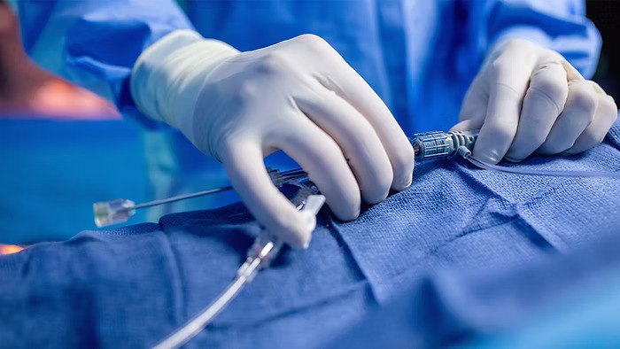 Interventional Radiology Market by Segmentation, Review, Trends, Opportunities, Growth, Demand and Forecast to 2030