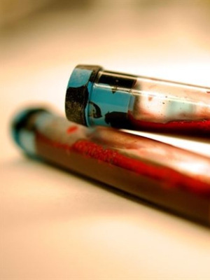 Early signs of Parkinson’s can be identified in the blood 