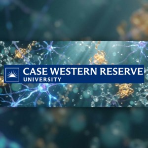 New Approach at Case Western Reserve Targets Root Causes of Parkinson’s