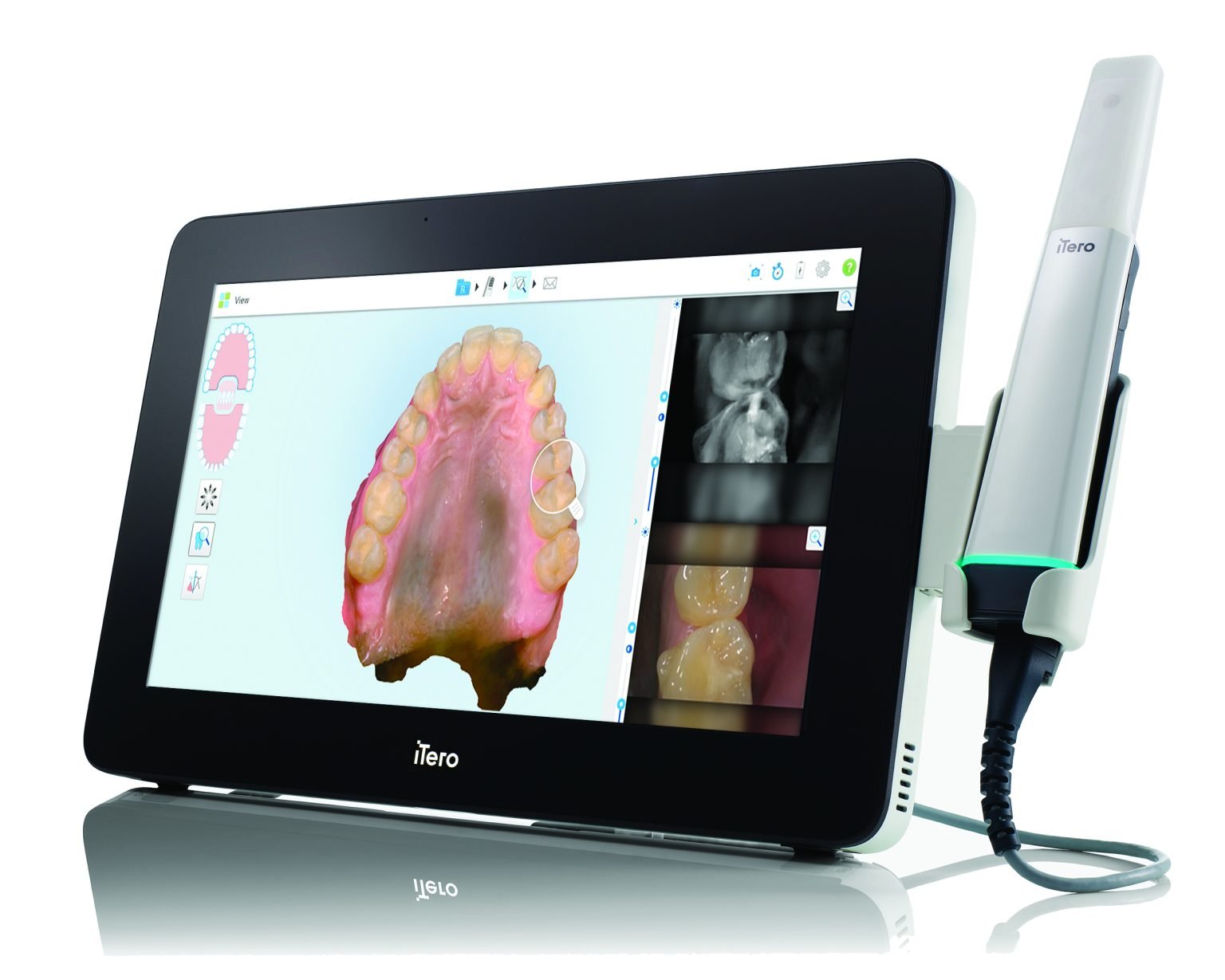 National oral health study powered by digital dentistry 