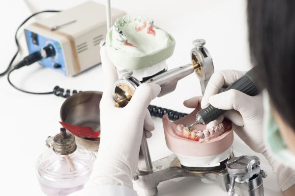 Dental Laboratory Services Market Analysis, Size, Share, Demand, Growth by Region and Forecast, 2030