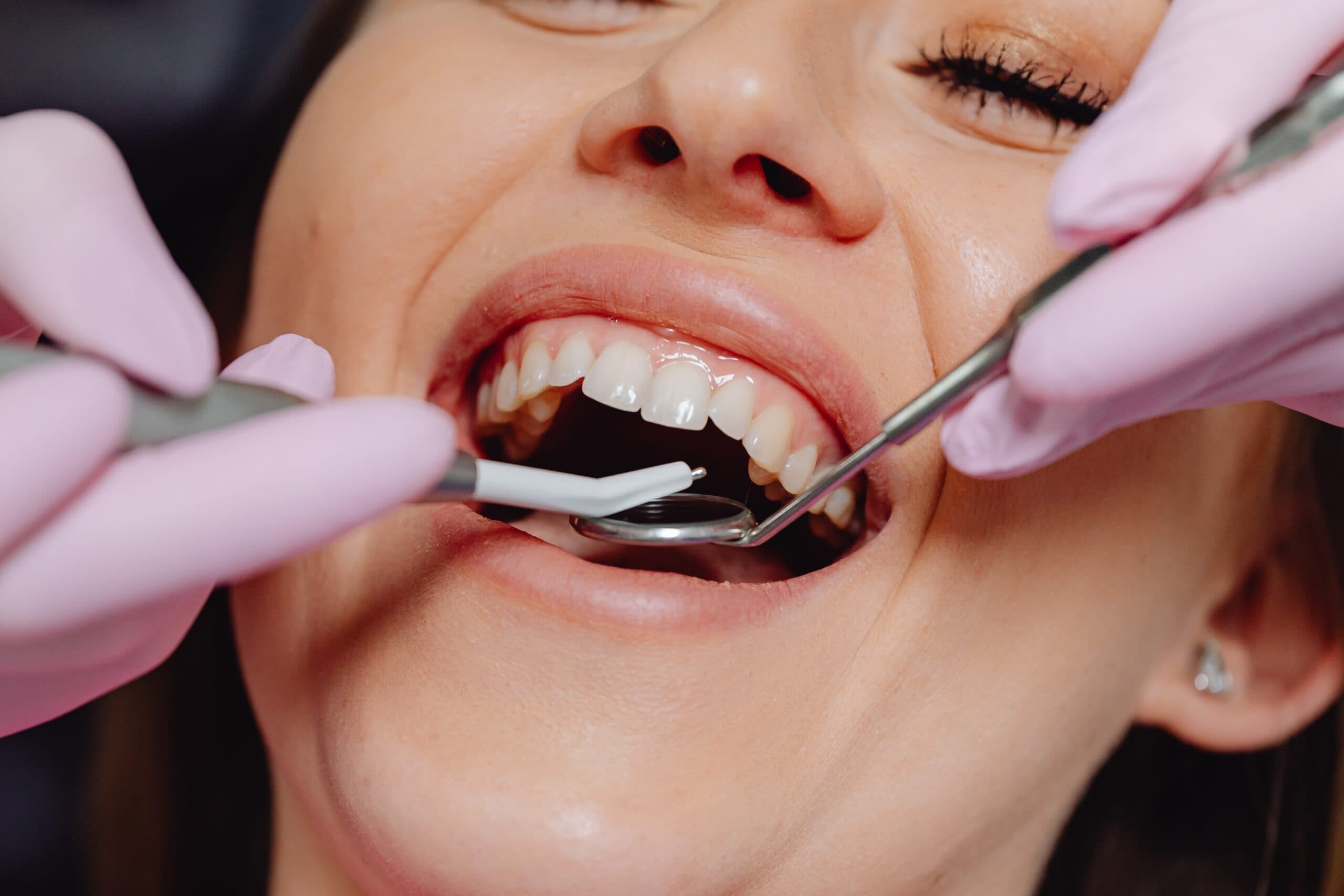 Dental Flap Surgery Market Research Report, Analysis, Size, Share, Growth and Forecast 2026-2030