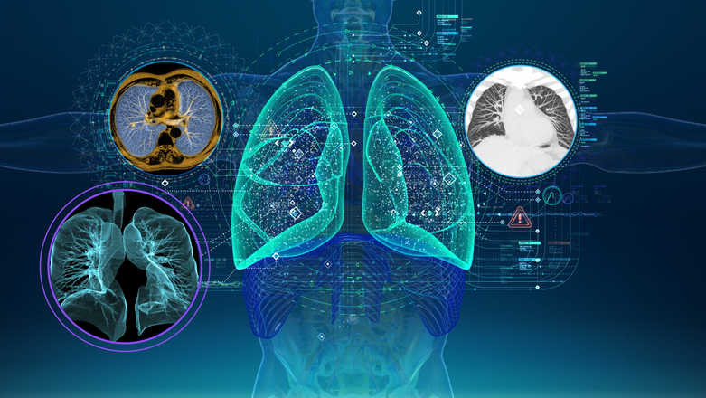 Healthcare Digital Twin Market Analysis 2030 | Technology, Applications, and Impact and Forecast 