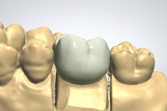 Dental CAD/CAM Market: Global Market Growth Study, Future Trends, Demands, and Top Players Data by Forecast to 2031