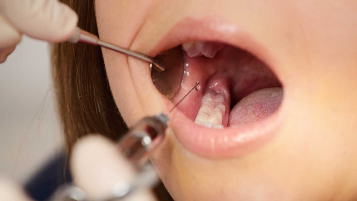 Dental Anesthesia Market Research Report, Analysis, Size, Share, Growth by Forecast to 2031