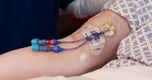 Catheter Stabilization Devices Market Executive Summary, Segmentation, Review, Trends, Opportunities, Growth, Demand and Forecast to 2030