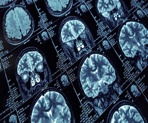 Medical Imaging Market Comprehensive SEO Analysis, Trends, Growth Drivers, and Regional Outlook