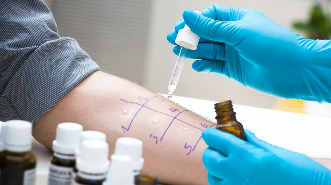 Allergy Diagnostics Market | Size, Growth and Forecast 2026-2025