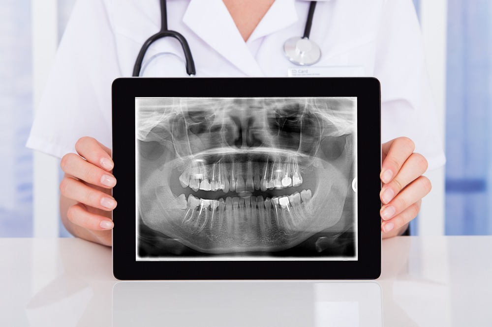 Dental Imaging Market Analysis, Size, Share, Top Companies and Research Report by 2035
