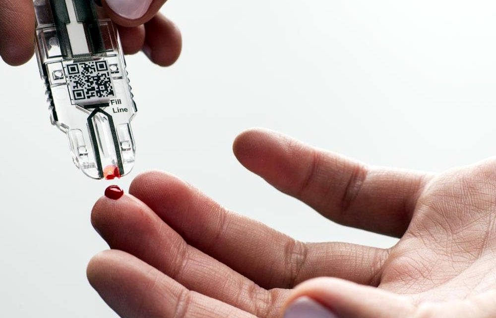 Point of Care Diagnostics Market Size, Development, Key Opportunity, Application & Forecast By 2035