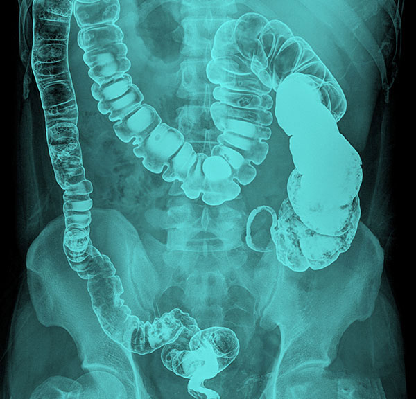 Contrast Media Market Outlook, 2029: Advancing Medical Imaging Solutions