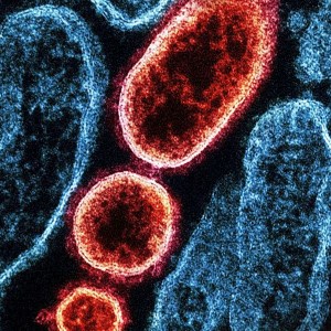 Centella compound shows promise against drug resistant bacteria