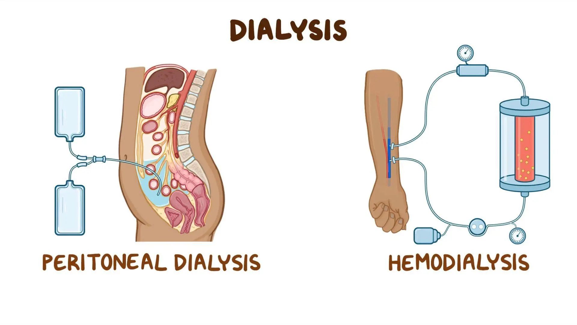 Dialysis Market Report Size, Top Players, Forecast, Growth Rate, Constraints, Future Trends, Events, And Challenges Until 2030