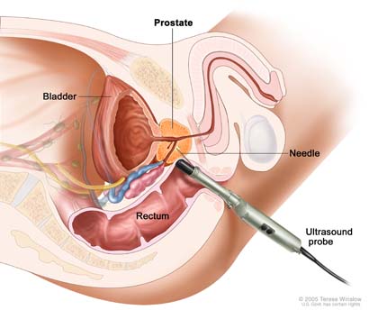 Urology Ultrasound Devices Market Analysis by Application, Type, Technology, and Geography - Global Industry Outlook and Forecast 2026-2030