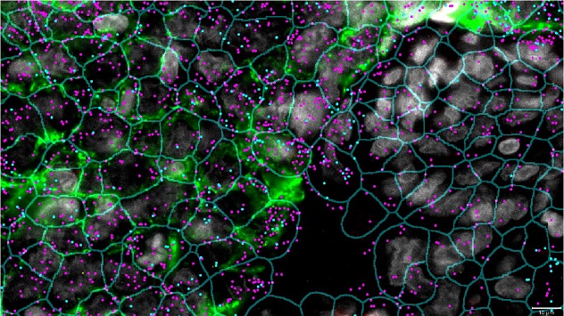Spatial Biology Market 2025-2030 | Analysis, Forecast, Size, Share, Growth, Trends and Insight