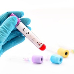 Anti-nuclear Antibody (ANA) Testing Market Size, Share, Industry Report, Growth and Future Forecast to 2025