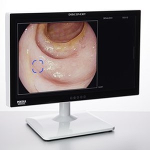 HOYA Group PENTAX Medical Cleared CE Mark for DISCOVERY(TM), an AI Assisted Polyp Detector