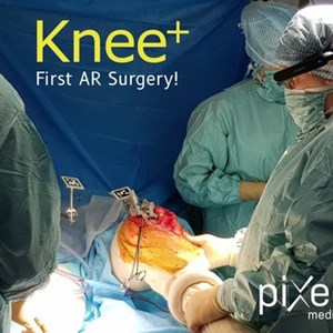 First Knee Replacement Surgery Successfully Completed Using Augmented Reality Technology from Pixee Medical AR Knee+ and Vuzix M400 Smart Glasses
