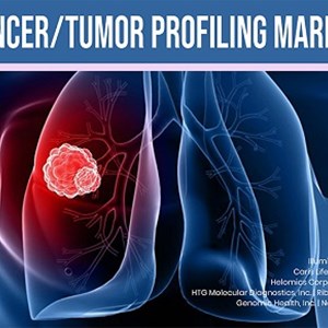 North America is Largest Cancer/Tumor Profiling Market